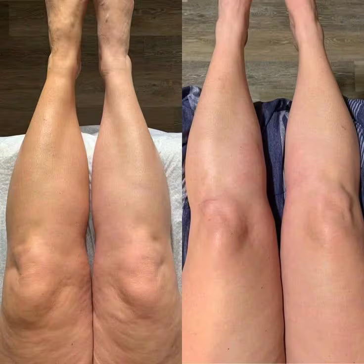 Drainage Lymphatique Liquide – Visage Affiné, Jambes Légères, Ventre Plat