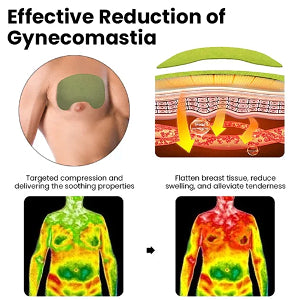 Patch de compresse pour gynécomastie
